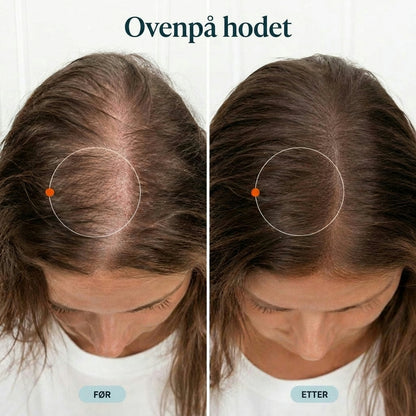 Korea #1 Hårvekstserum™
